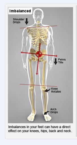 Pelvic imbalance