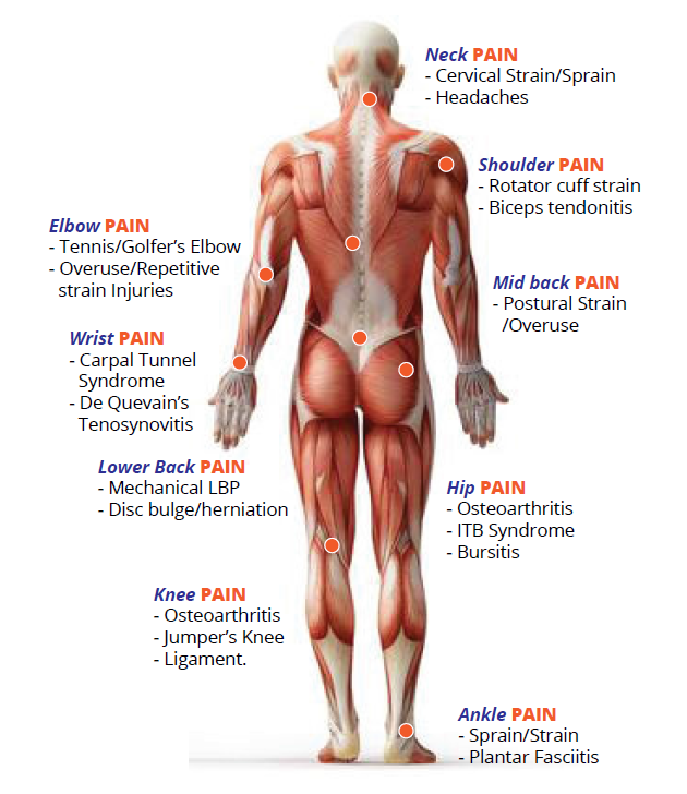 physiotherapy-diagram