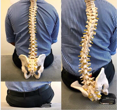 Stop Sitting on Back Pain: How Your Wallet Causes Sciatica and Discomfort