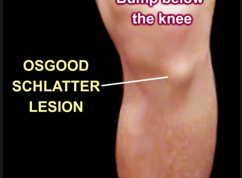 Help! My Child Is Complaining Of Knee Pain