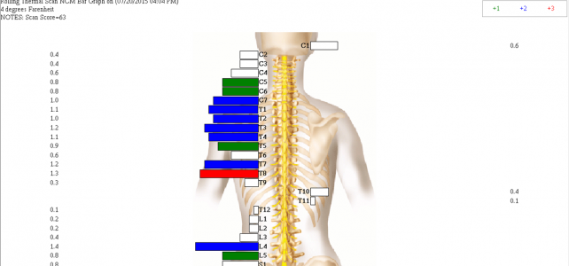 Spine Screening