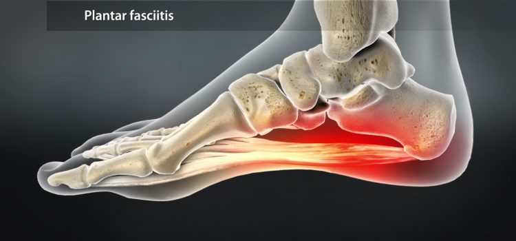 Do You Suffer From Sole Pain!?