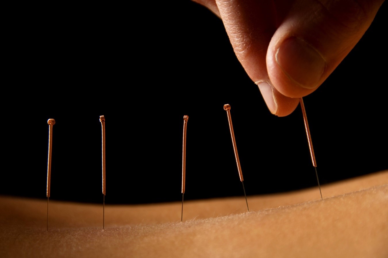 What Is Dry Needling/Ims And Is It Right For Me.