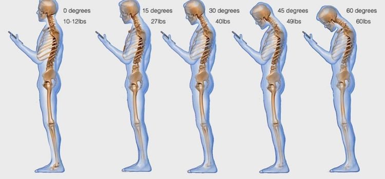 Combating Text Neck: Tips To Reduce Strain And Improve Posture