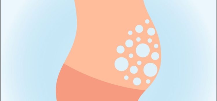 Physiotherapy for Abdominal Bloating: Natural Relief Techniques in Kenya.