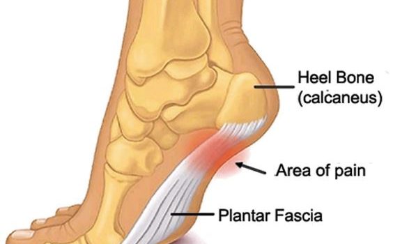 Beyond The Heel