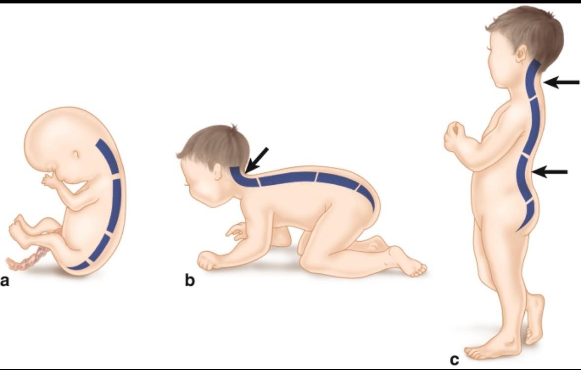 Tiny Spine, Big Future: What Every Parent Should Know